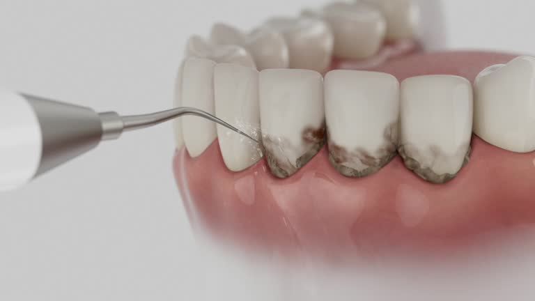 Reliable Emergency Dentist contractor in Beaver, UT by Smile Center Dentistry